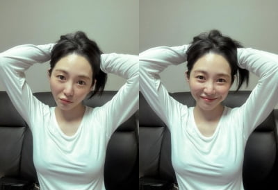 '잠정 은퇴' 권민아 '피부과 상담 실장' 5일 앞두고 '뾰루지' 당당 공개