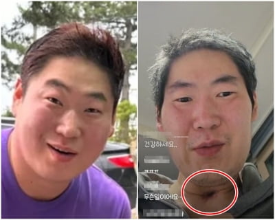 목에 삽관 흔적까지…투병중인 19기 영철, 야윈 근황 "병명 말하기 어려워"[TEN이슈]