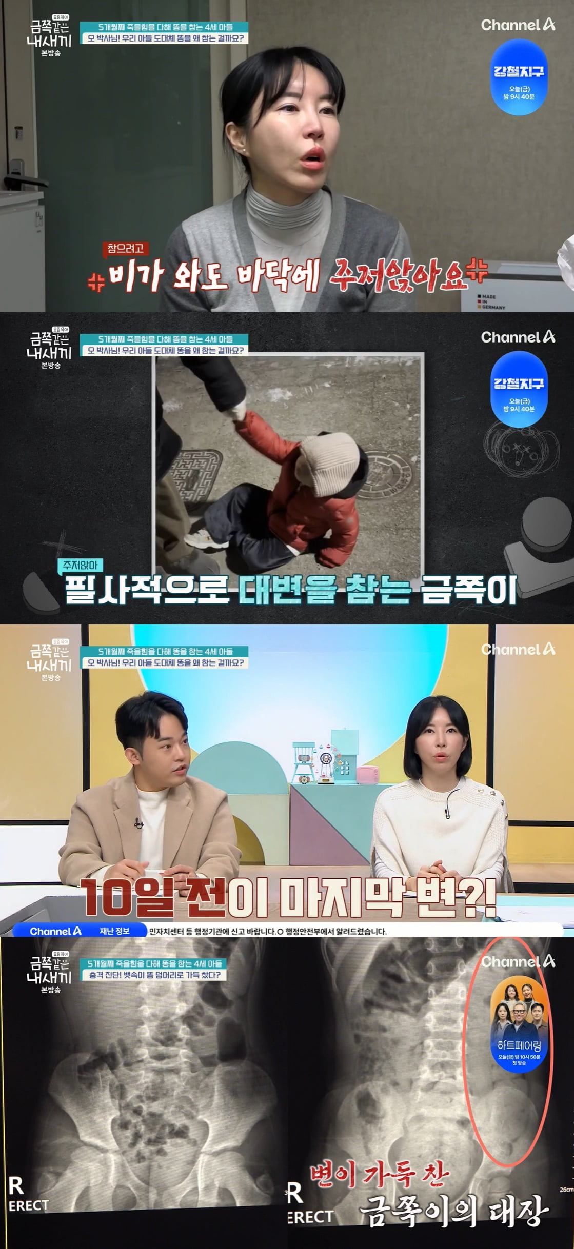4세 금쪽이, 엉덩이 틀어막아 배변 거부…"5개월째 참았다" '충격' ('금쪽같은')