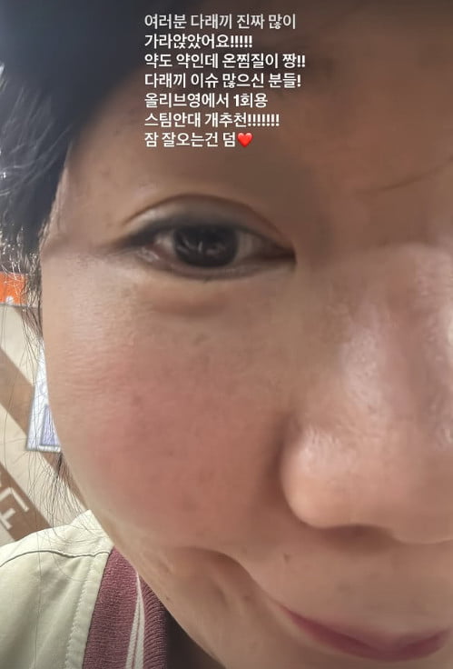 사진=허안나 SNS