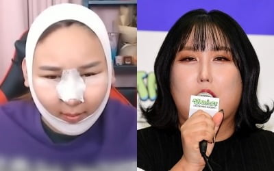 [종합] '한남동家 ' 풍자, 성전환 수술 2번 받았다…"14시간 대공사, 얼굴 갈아엎어" ('A급장영란')