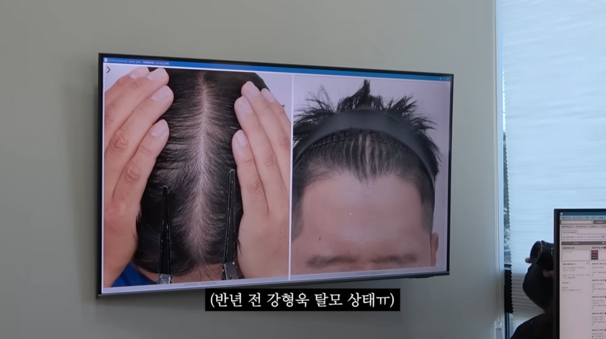 사진=유튜브 '보듬TV'