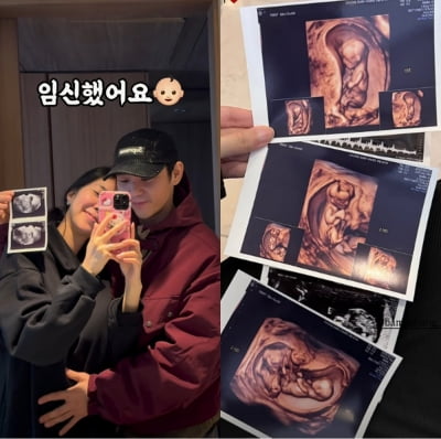 '시험관 성공' 김지혜, 뱃속 꼬물이 공개…'선명한 쌍둥이'에 설렘 MAX