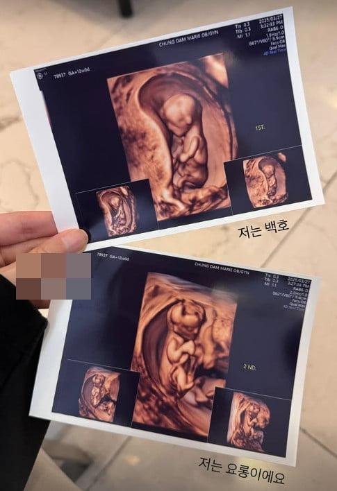 사진=김지혜 SNS