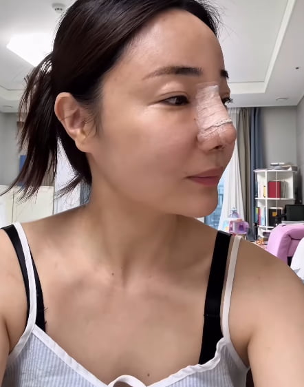 SNS