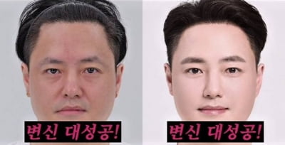 노유민 맞아?…눈 시술로 '10년' 역행→44세에 "민증 검사 받는다"