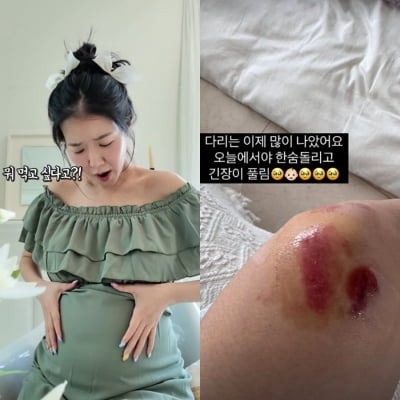 김지혜, 심각했던 낙상 사고 상황…쌍둥이 무사했던 건 '기적'