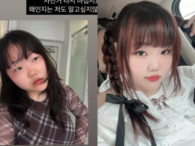 이수현, 제주서 얼굴에 무슨 일이…"마스크 끼고 자전거 타지 마세요"