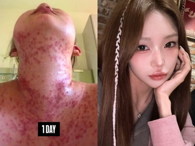 '故최진실 딸' 최준희, 투병 시절 보니 끔찍…"인생 최저점이었다"