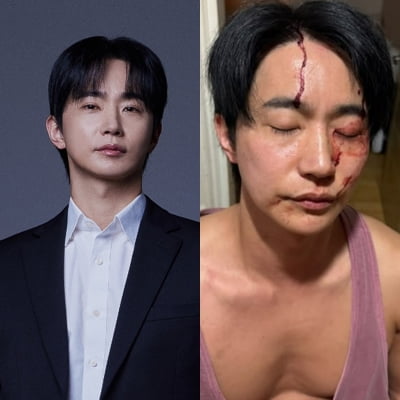 [종합] 전여친 "폭행에 성병 옮겨" 폭로에…전호준, 피 흘리는 사진+녹취록 공개