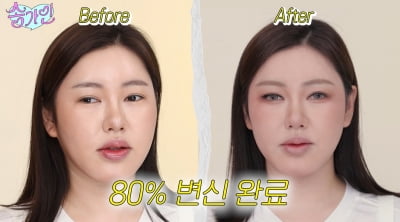 송가인 "나 뭐 돼"…코 수술 의혹 부른 역대급 변신
