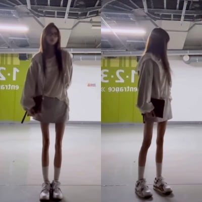 어떻게 서 있는 거야…최준희 '뼈만 남은 다리', 실제로 보면 이 정도
