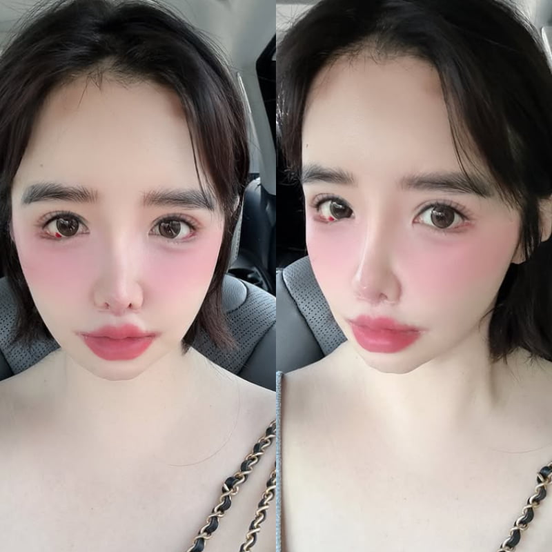 '2NE1 美 공연 불참' 박봄, 눈 빨갛게 충혈됐다…"대체 무슨 일이냐"