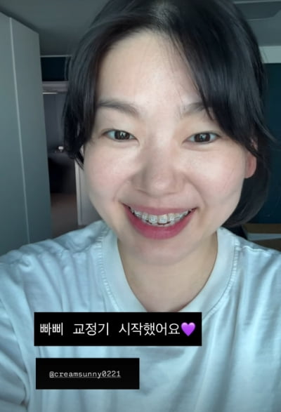 '옥주부' 정종철, ♥아내 모임에 명품팩 쏘더니 치아 교정까지…딸처럼 '우쭈쭈'