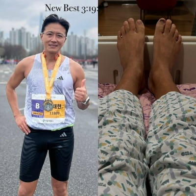 진태현, 오전 11시 갑상선 암 수술…"일면식 없던 김우빈이 챙겨줬다"
