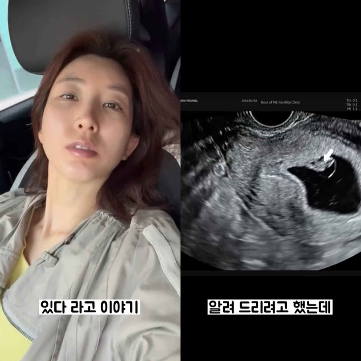 /사진 = 박인영 인스타그램