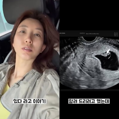 '이특 누나' 박인영, 4월 유산 고백 "아기별로 보냈다, 울컥울컥" 응원 봇물 [TEN이슈]