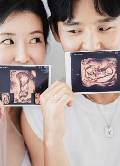 '낙상사고→성별교체' 김지혜, 만삭 사진이라는데 'D라인'은 어디에