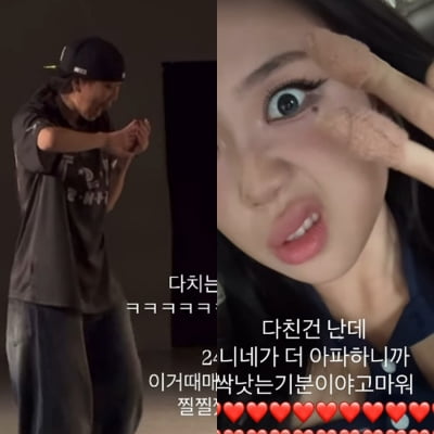이영지, 촬영 중 손가락에서 피 봤다…곧바로 정형외과 行