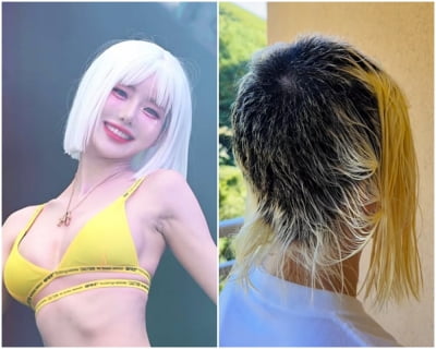 "전체 머리의 10% 남아, 학대당한 강아지 같다고"…DJ소다, 참담한 심경 고백