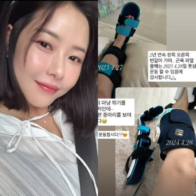 박하나, 이현이 '산재 고백' 하루 만에 "근육 파열" 언급…SBS에 보상 못 받았나