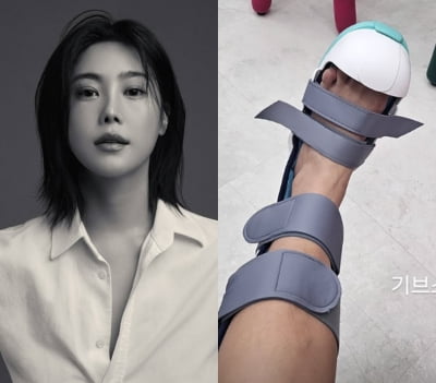 가수 솔비, 부상 소식 전했다…발가락 두 배 부풀어 "모든 일정 어쩌나"