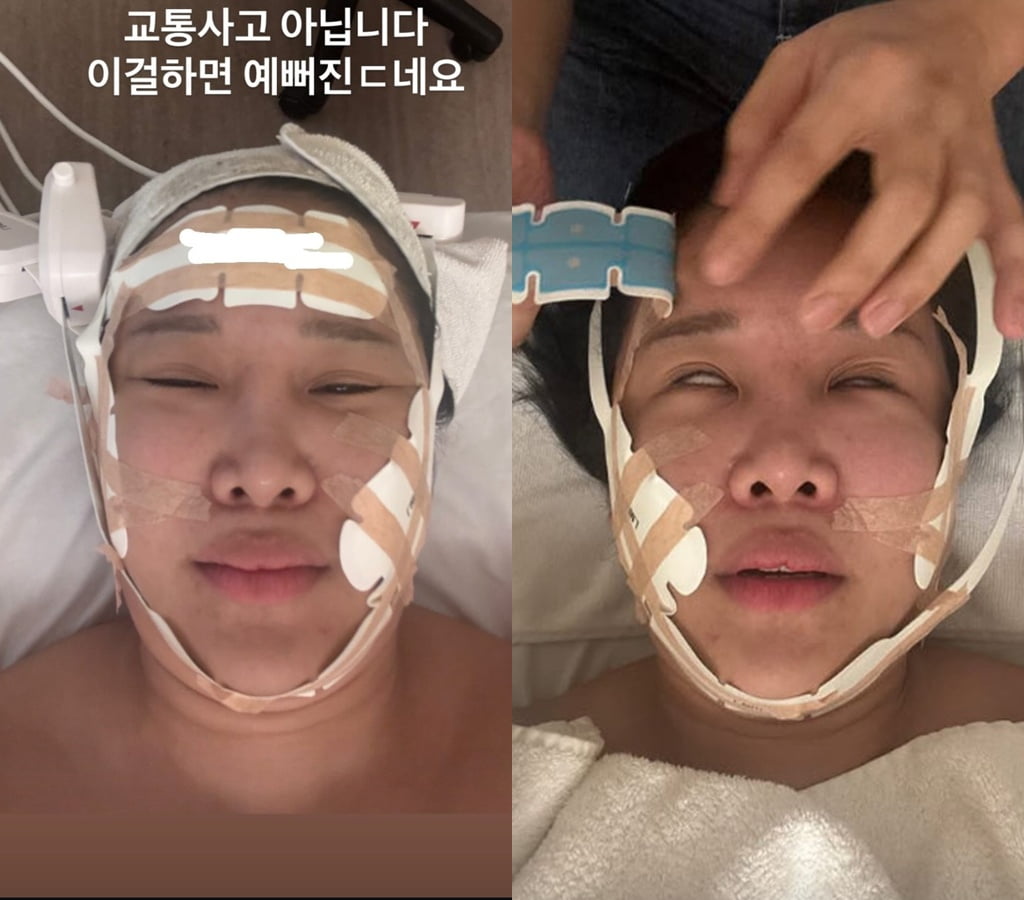 사진=랄랄 SNS