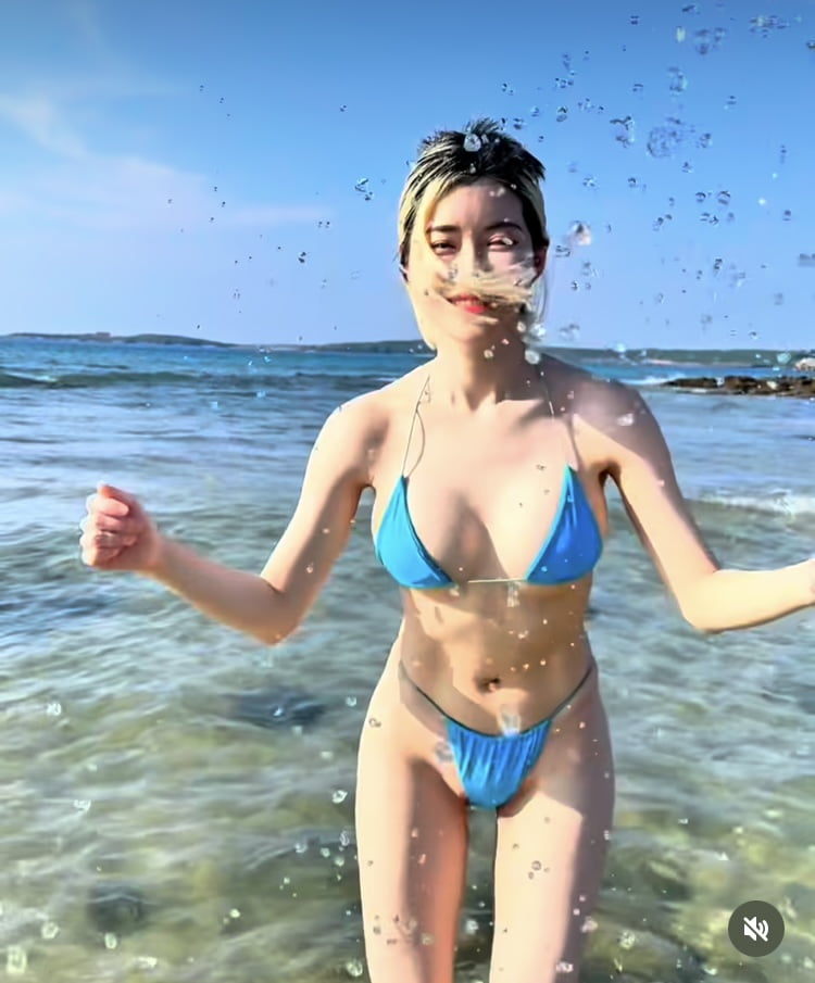 ‘부분 삭발’ DJ소다, 가발없이 당당하게…잔머리도 빼꼼