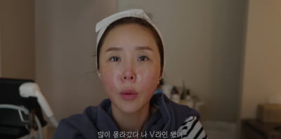 광대치고 턱 깎았냐고?…'7살 연하♥' 신지 "수술 NO, 코도 안 했는데"('어떠신지')