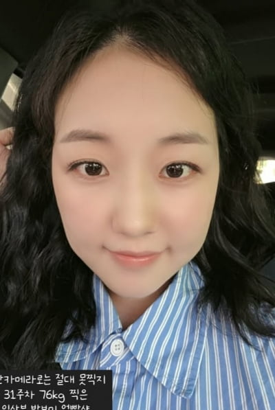 박보미, 발까지 270mm 됐다…출산 '18일' 남기고 각종 불편감 호소