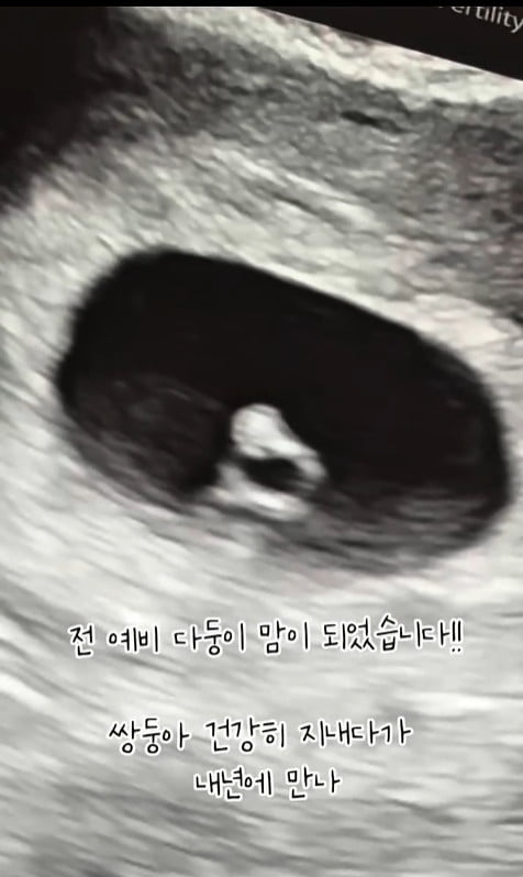 사진=오초희 SNS