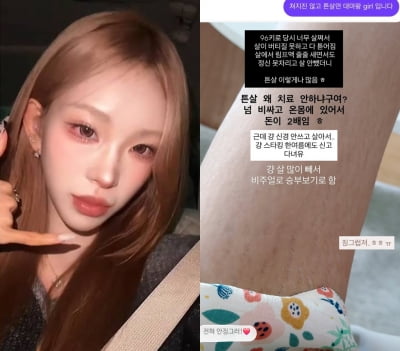 "튼살로 비키니 못 입어"…故최진실 딸, 피부 공개하며 "징그럽죠"