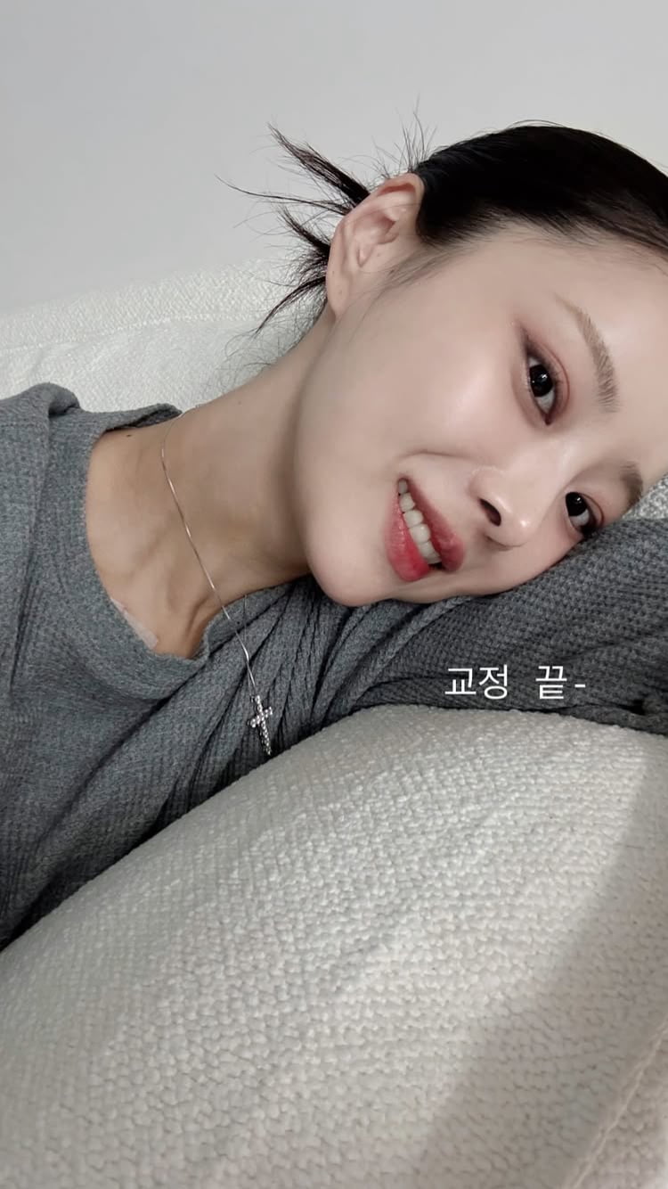 10기 옥순, 이혼설 종결하고 교정도 끝나고…V라인 어마무시