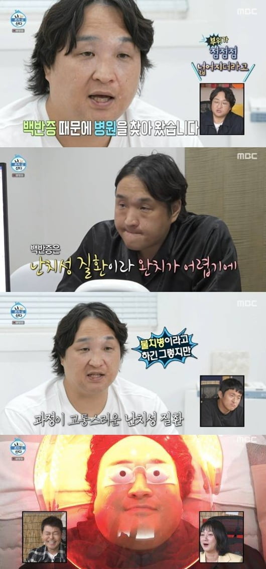 [종합] '건물주' 구성환, 난치성 질환 고백했다…"상태 좋지 않아, 고치기 쉽지 않다고" ('나혼산')