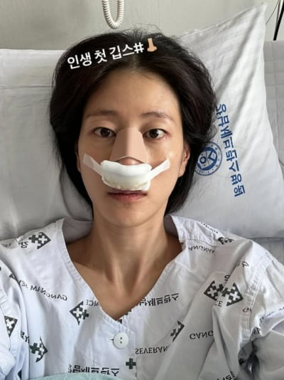이현이, 코뼈 골절로 인생 첫 깁스…"숨 못 쉬어 죽었을 것"