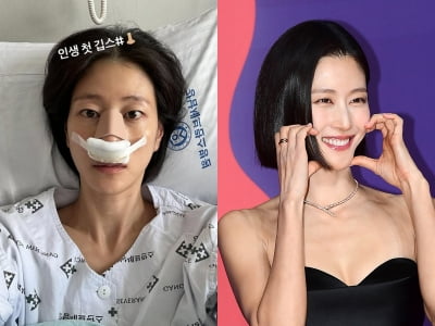 이현이, 코뼈 골절 소식 하루만에 기쁜 소식 전했다…"완벽하게 복원됐다"('라디오쇼')