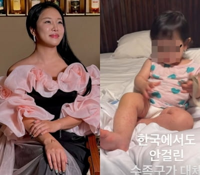 랄랄 딸, 해외서 '수족구병' 걸렸다…허벅지까지 전이된 상황