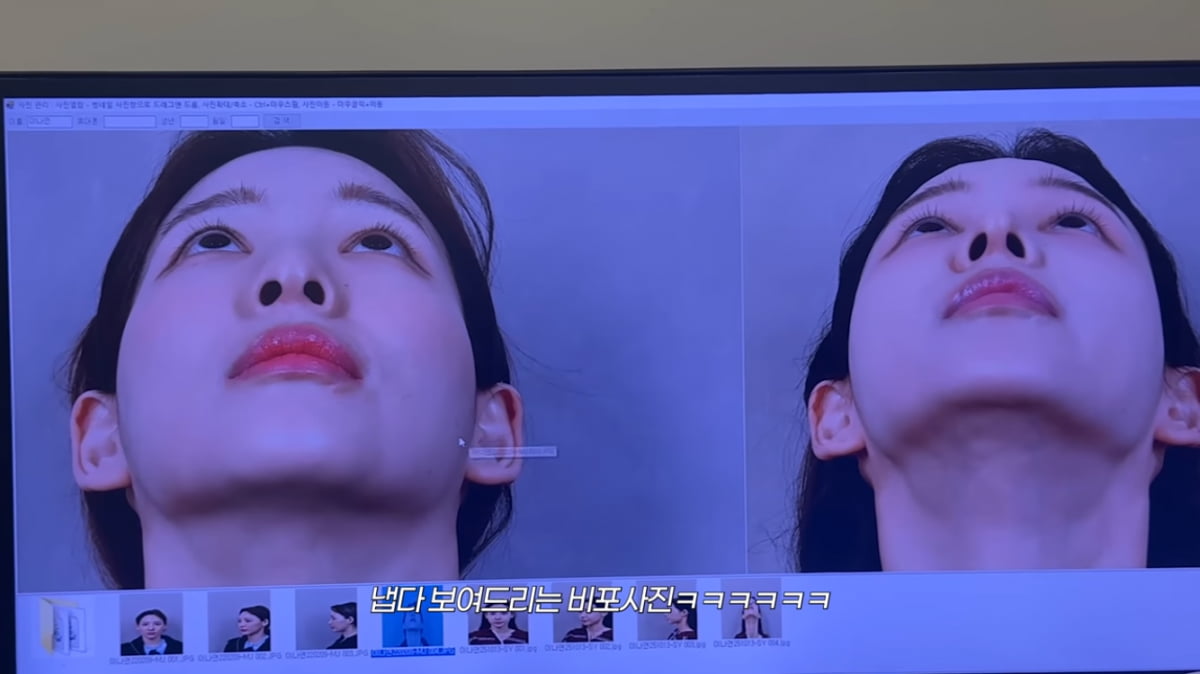 이나연 아나, 코 성형 또 할까…“옛날 얼굴 그리워” 복원 고민