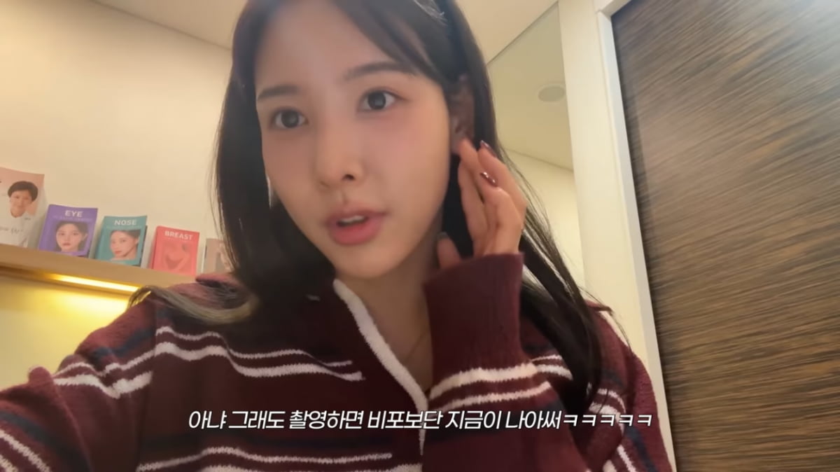 이나연 아나, 코 성형 또 할까…“옛날 얼굴 그리워” 복원 고민