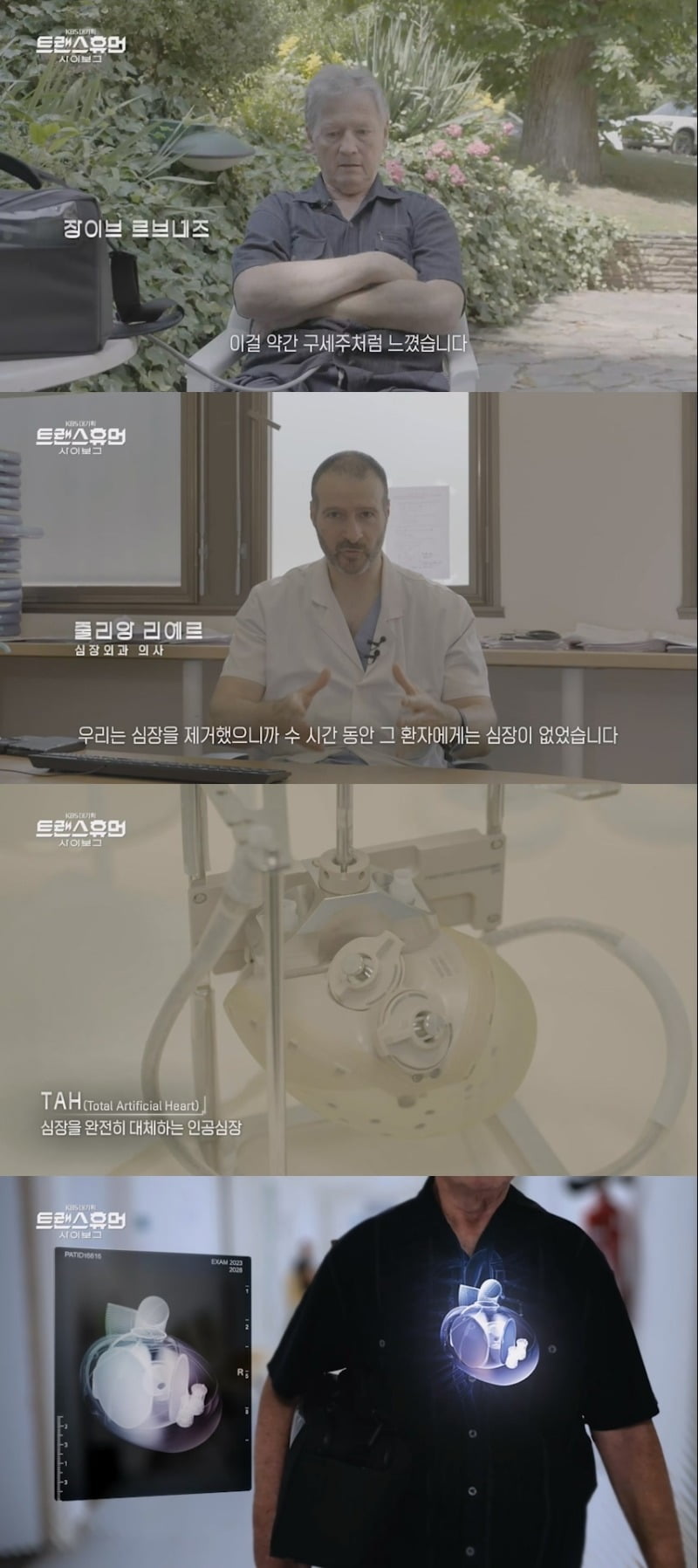 사진제공=KBS 1TV