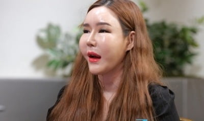 성형에만 1억 4000만원 쏟았는데…서장훈 "이미 수술 많이 해, 더 가면 망쳐" 일침 ('물어보살')