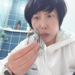 탈모 천만 명 시대, 우비소녀 권진영도 겪었다… “배수구에 모여 있어”