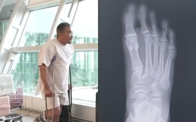 '야노시호♥' 추성훈, 결국 하차했다…"촬영 중 뼈 골절" 응급실 行, 기안84에 사과 ('극한84')[종합]