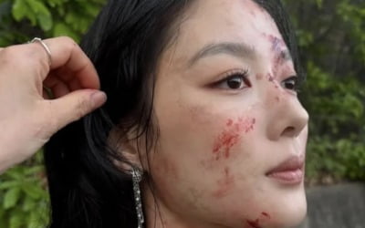 김유정, 피투성이 얼굴 근황 알렸다…"너무 고생했다"