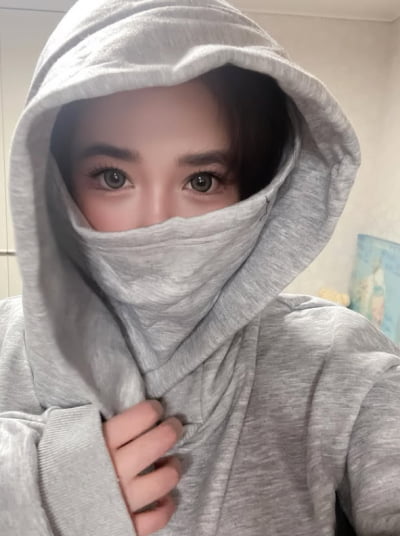 박봄, 실핏줄 다 터졌었는데…다행히 눈 상태는 회복