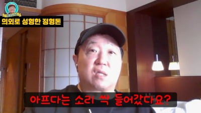 정형돈, 성형 전 사진 공개…"아프단 소리 싹 사라졌다"