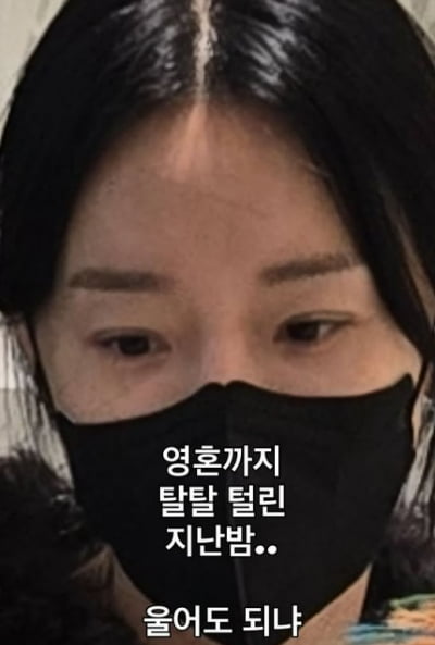 '인중축소술' 이지혜, 극한 상황 맞았다 "가족이 다 X고생…집 나가고 싶었어"