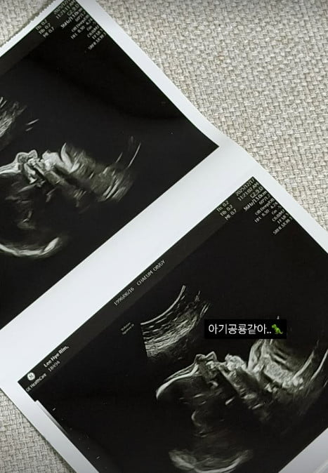 사진=이혜림 씨 SNS