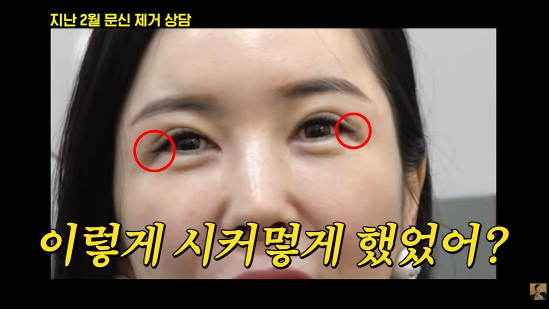 사진 = 유튜브 채널 'A급 장영란'