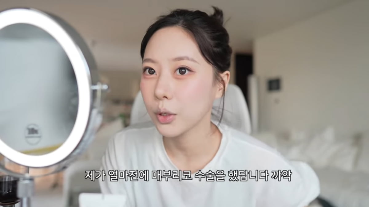 ‘환연’ 고민영, 코 성형수술 고백해…“코끝 NO, 매부리만”(‘곰민영’)